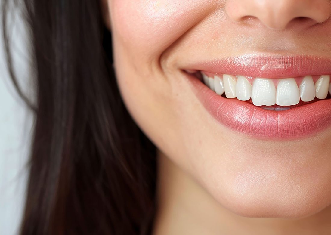 Cosmetic Dentistry in Monroe, CT